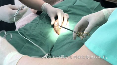 性転換大腸法|【男性から女性への性転換】わたしはS字結腸法で手。